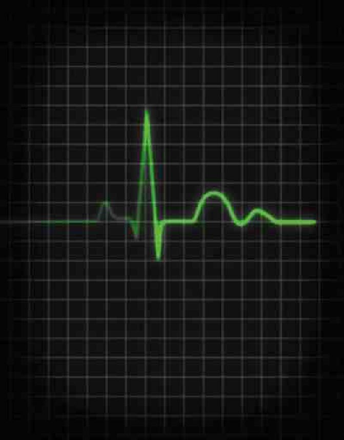 Breathing New Life Into Brokers Image