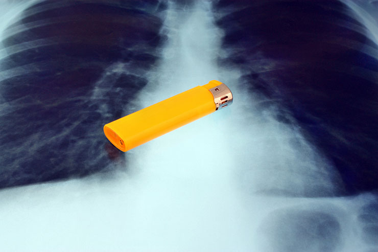 Tobacco lawsuit defence set back by Supreme Court of Canada Image