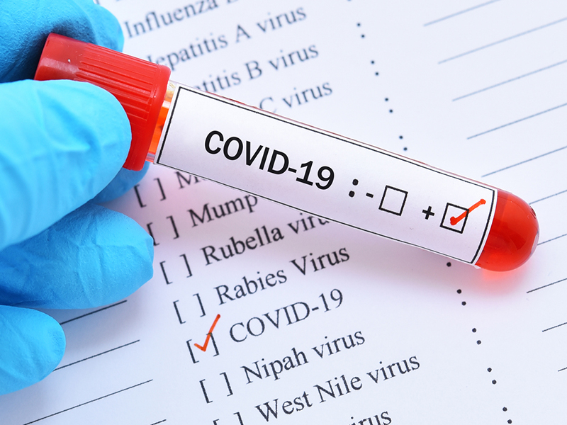 Intact warns of indirect economic impact from COVID Image